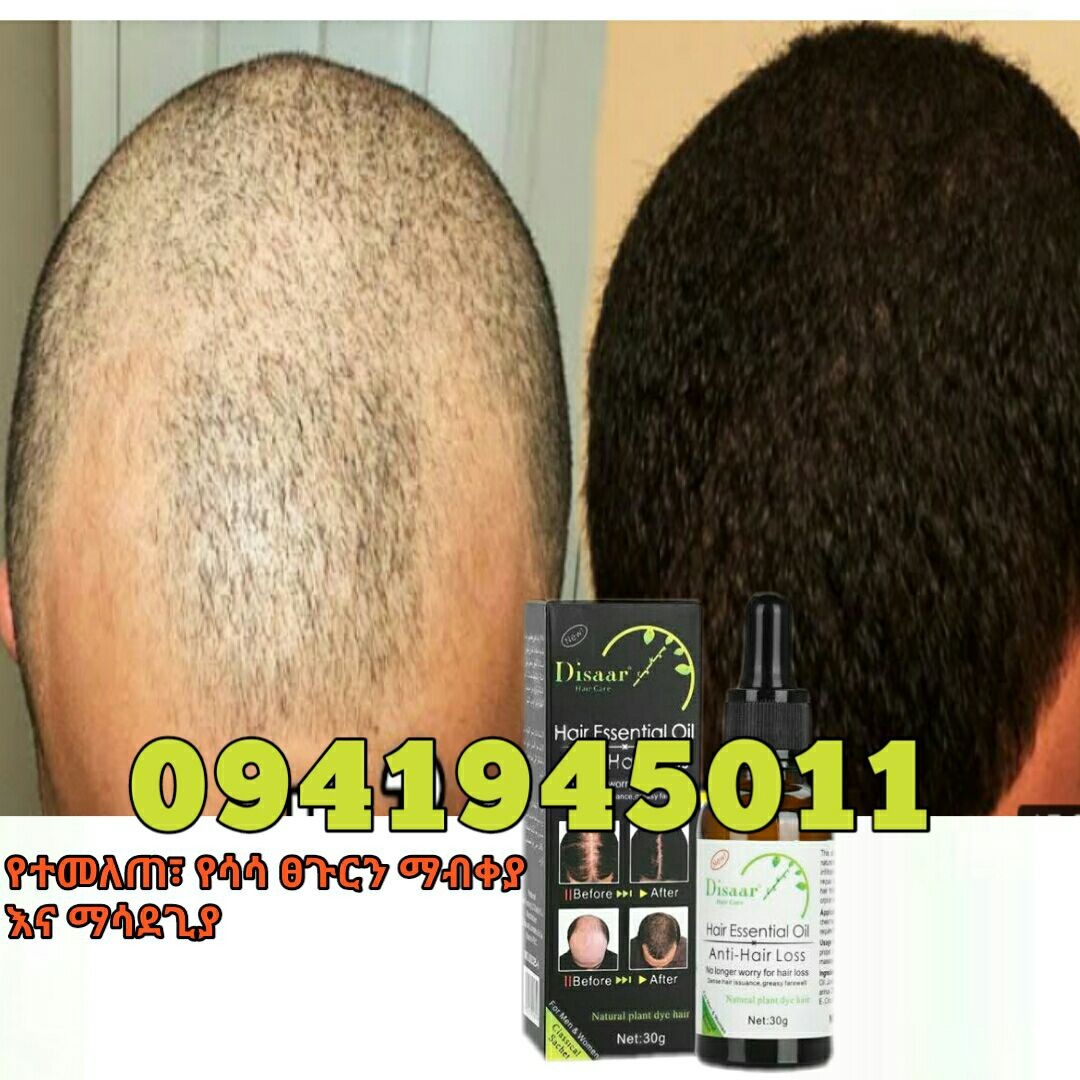 Hair growth oil 