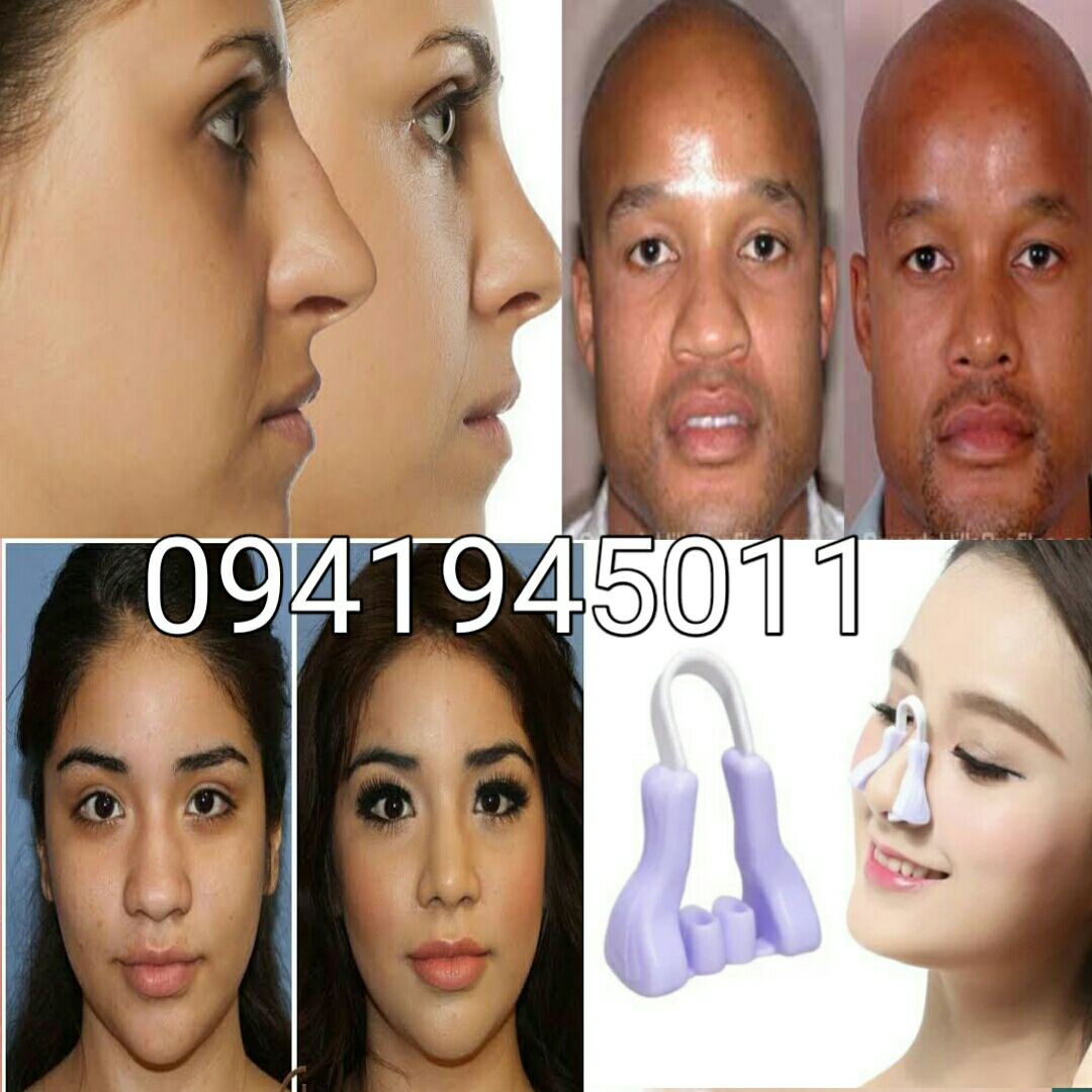 Nose corrector á‹¨áŠ ááŠ•áŒ« áˆ›áˆµá‰°áŠ«áŠ¨á‹« 